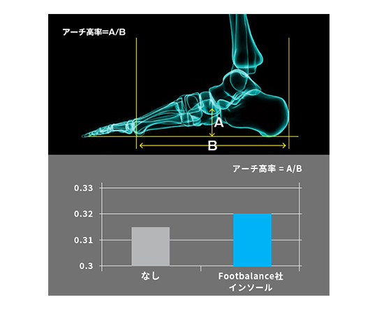 施術と経営の両立が可能！フットバランスインソールの魅力