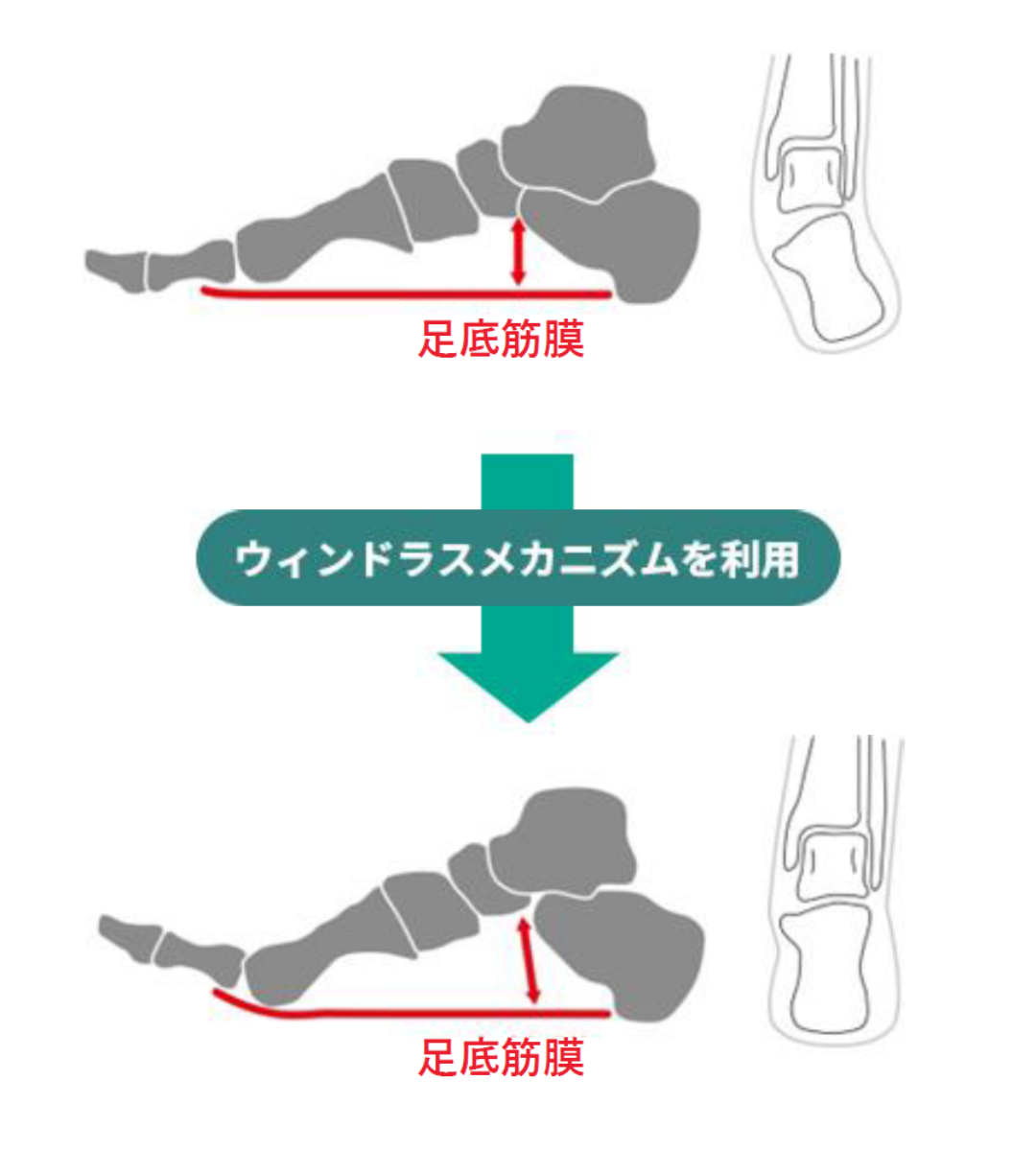 ウィンドラスメカニズムの利用