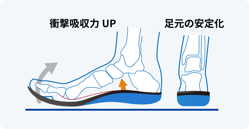 ウィンドラスメカニズム