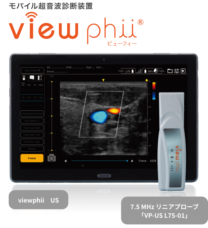 モバイル超音波診断装置 viewphii　viewphii US,7.5MHzリニアプローブ「VP-US L75-01」