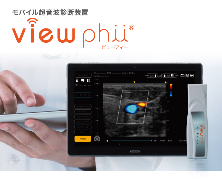 モバイル超音波診断装置 viewphii